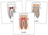 Tooth Nomenclature Cards - Montessori Print Shop